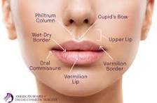 lip filler